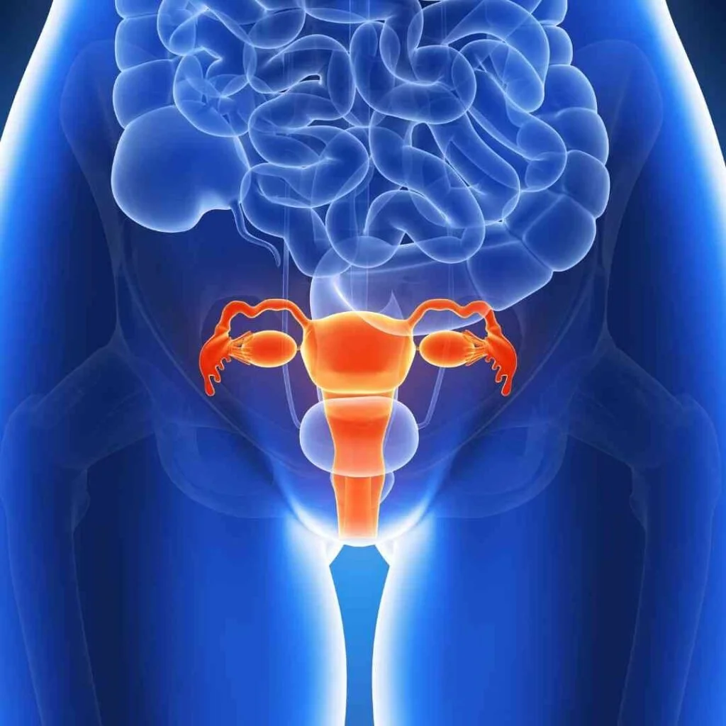 PCOD / PCOS & Ovarian Cyst